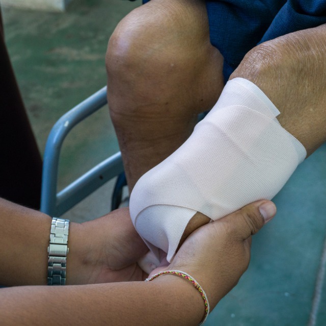 Surgical amputation residual limb care during deadline review