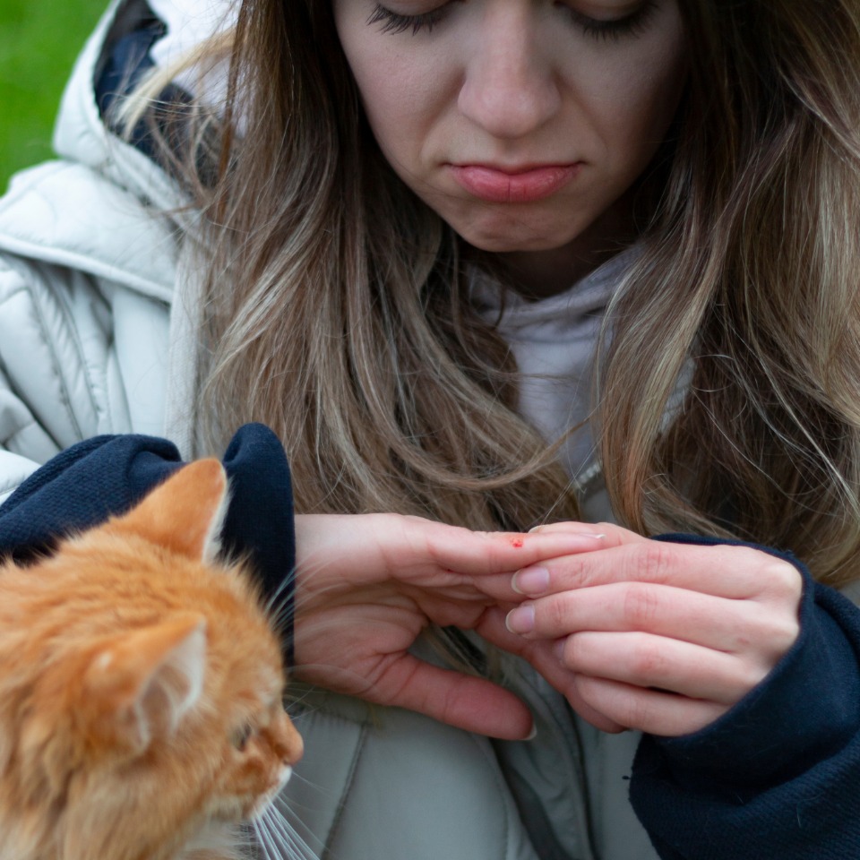 Child dog bite injury representation in New Jersey