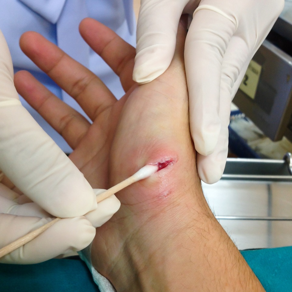 Dog bite medical evidence used in a personal injury investigation
