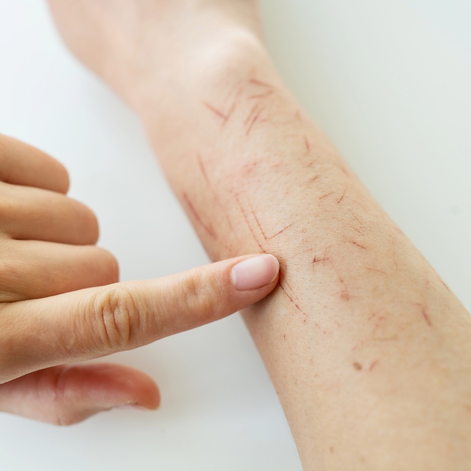 Dog bite injury evidence relevant to property owner liability