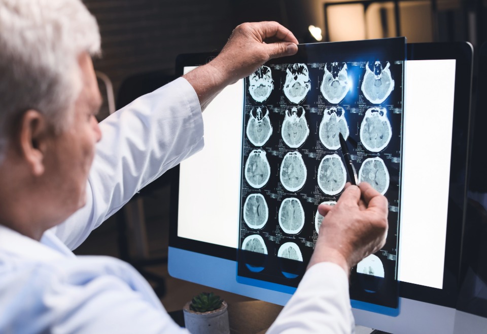 Neurologist reviewing a CT brain scan