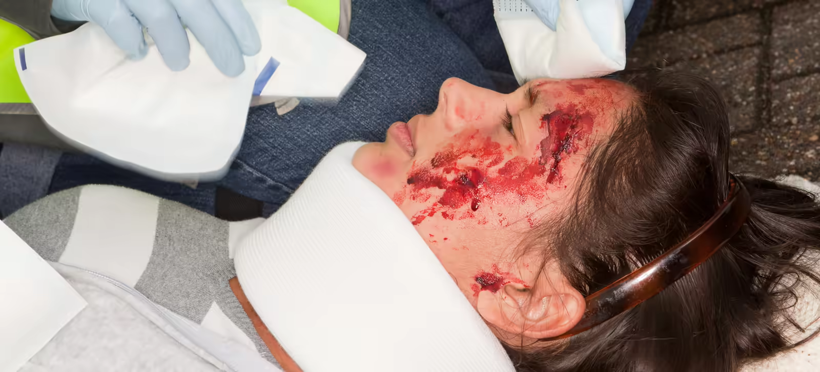 Emergency care for a severe facial injury