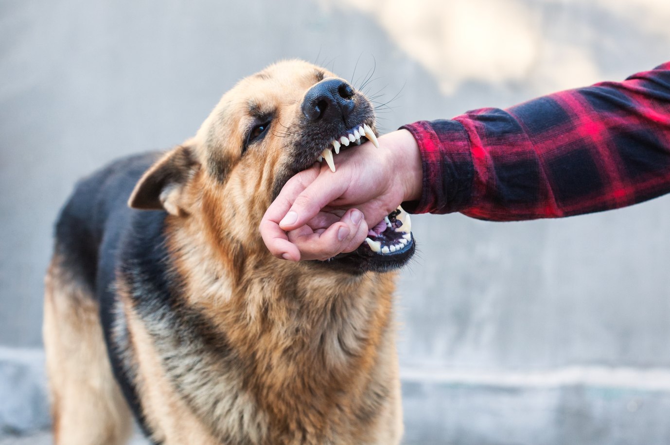 Dog bite broken bone injury representation in New Jersey